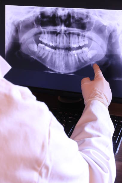 Best Emergency Wisdom Tooth Extraction in Providence Village, TX