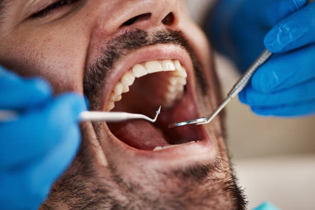 Best Emergency Dental Care for Sports Injuries in Providence Village, TX
