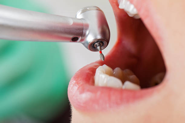 Best After-Hours Dental Care in Providence Village, TX